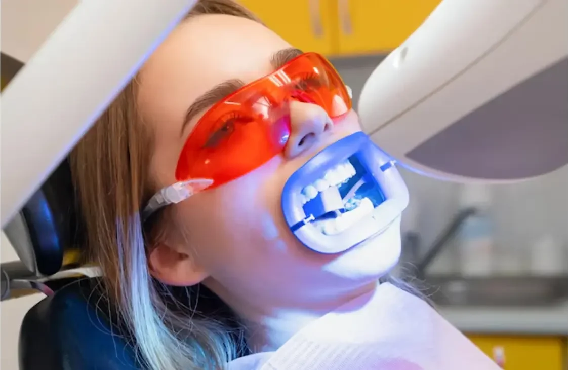 Teeth whitening service at ATOS Medical Center.