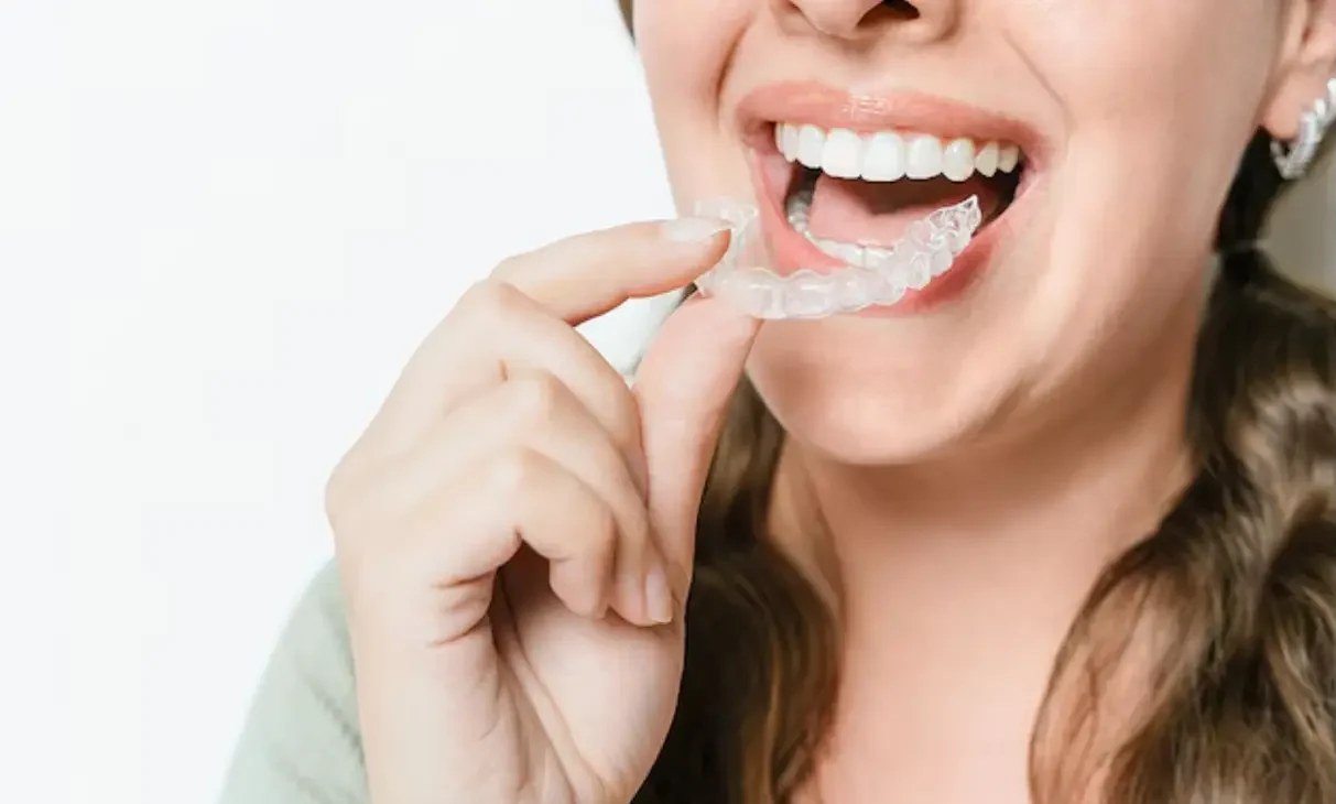 Clear Braces service for a confident smile