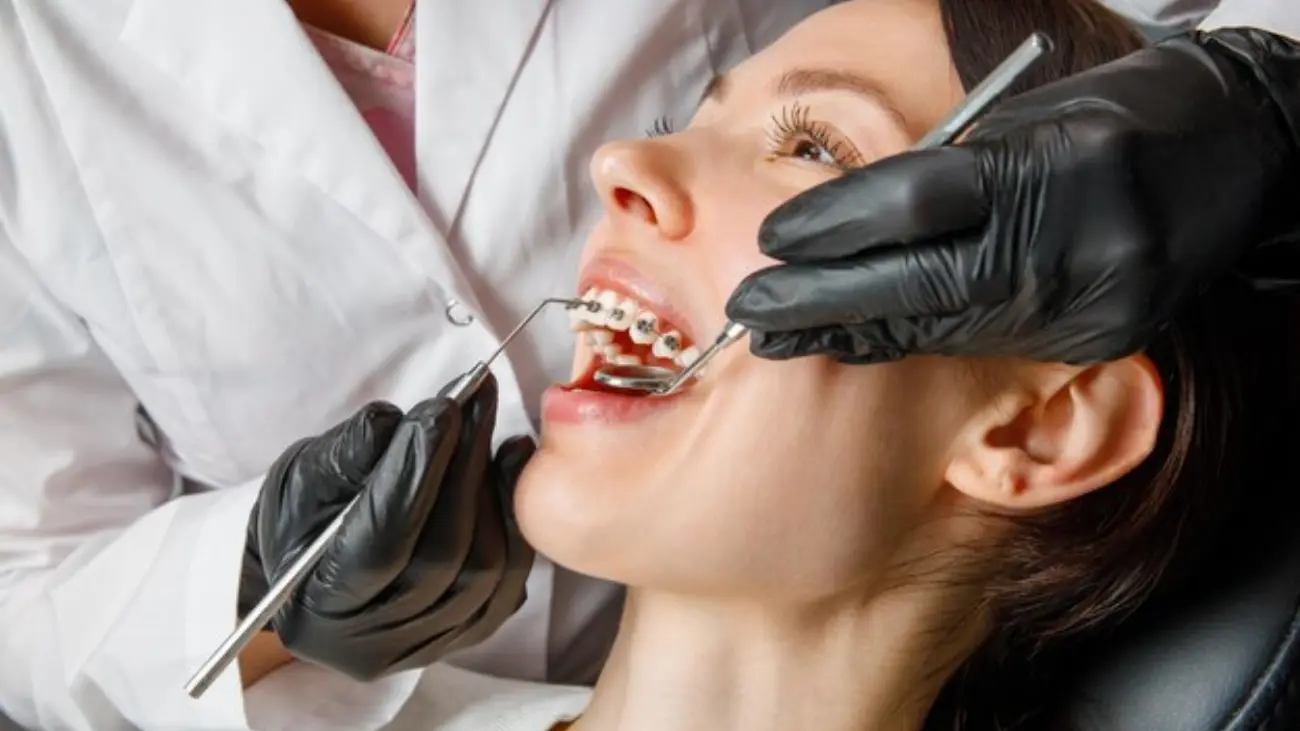 Transforming smiles with dental braces in Qatar