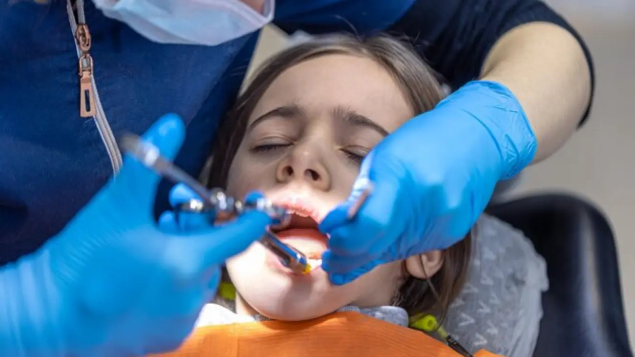 Understanding Tooth Decay Stages and Treatments