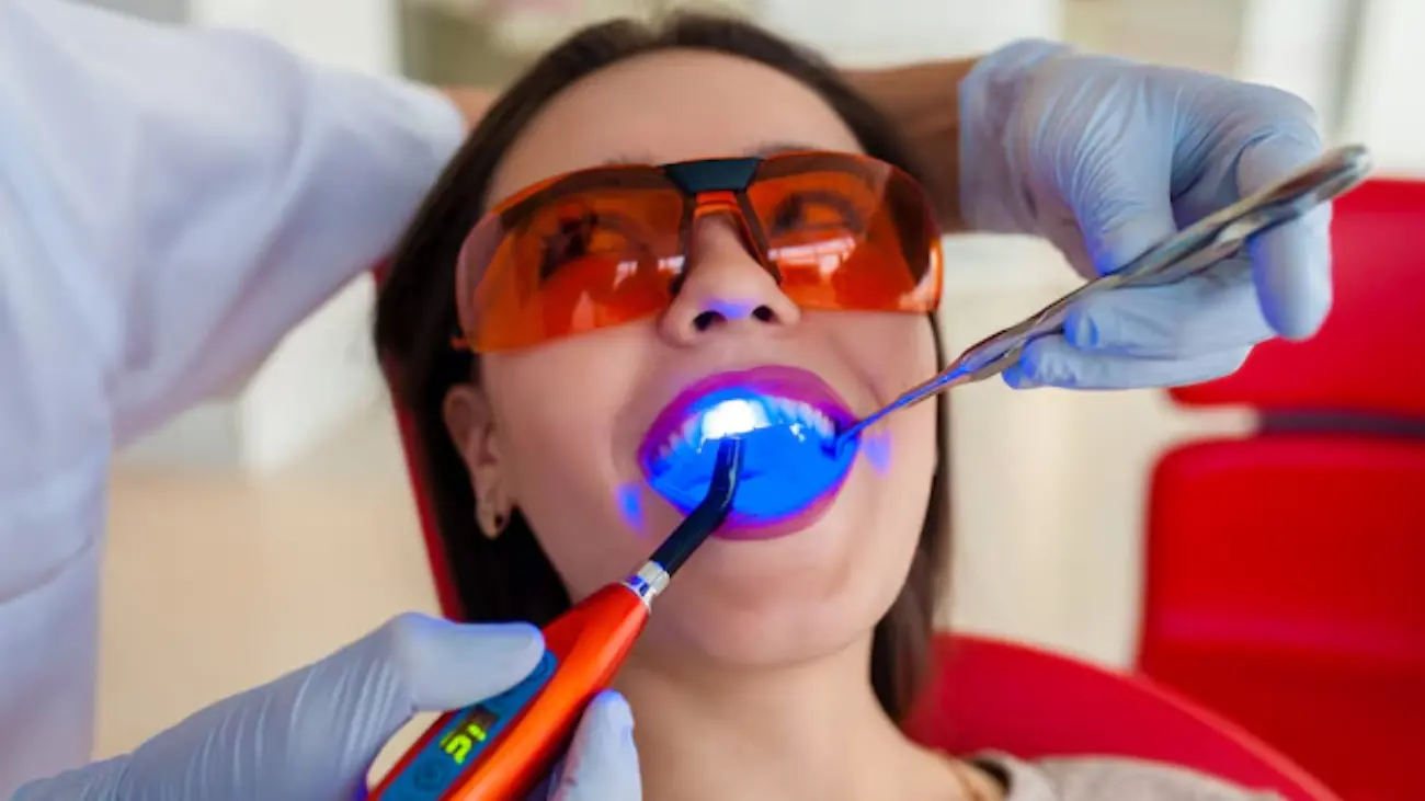 Image of Composite Filling Procedure at ATOS Medical Center