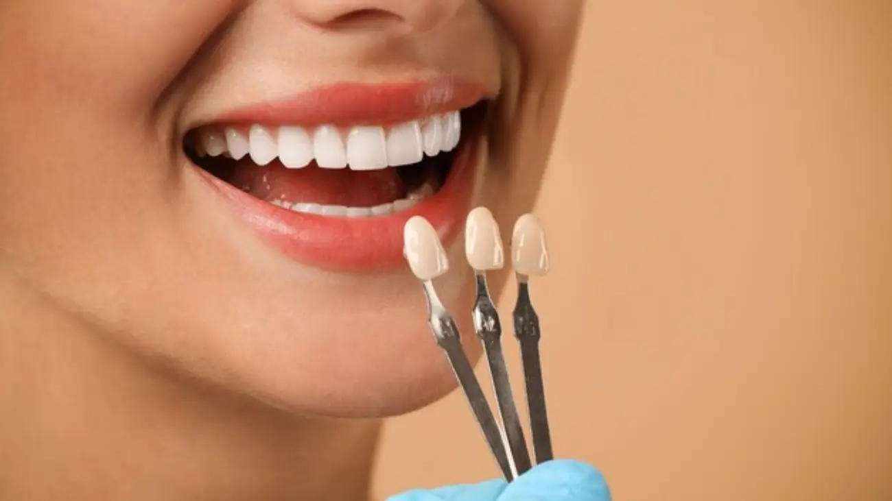 Dental Composite Solutions for Improved Oral Health