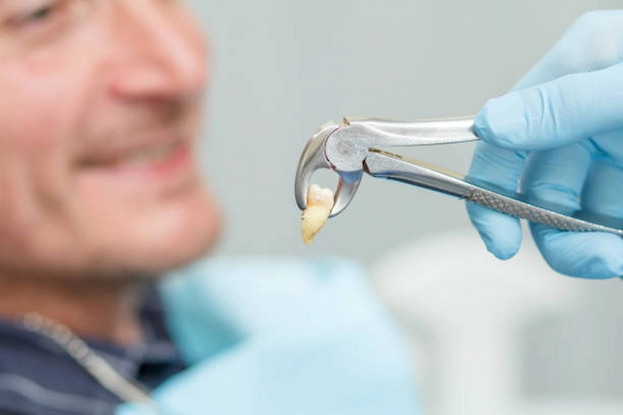 Emergency Tooth Extraction Service in Doha