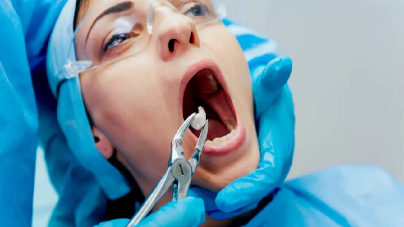 صورة توضح أعراض ضرس العقل المدفون