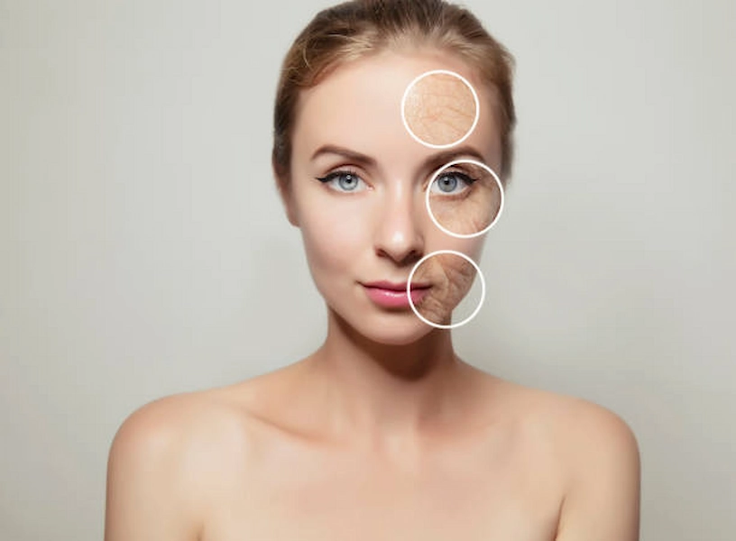 Spots On Skin Treatment options at ATOS Medical Center