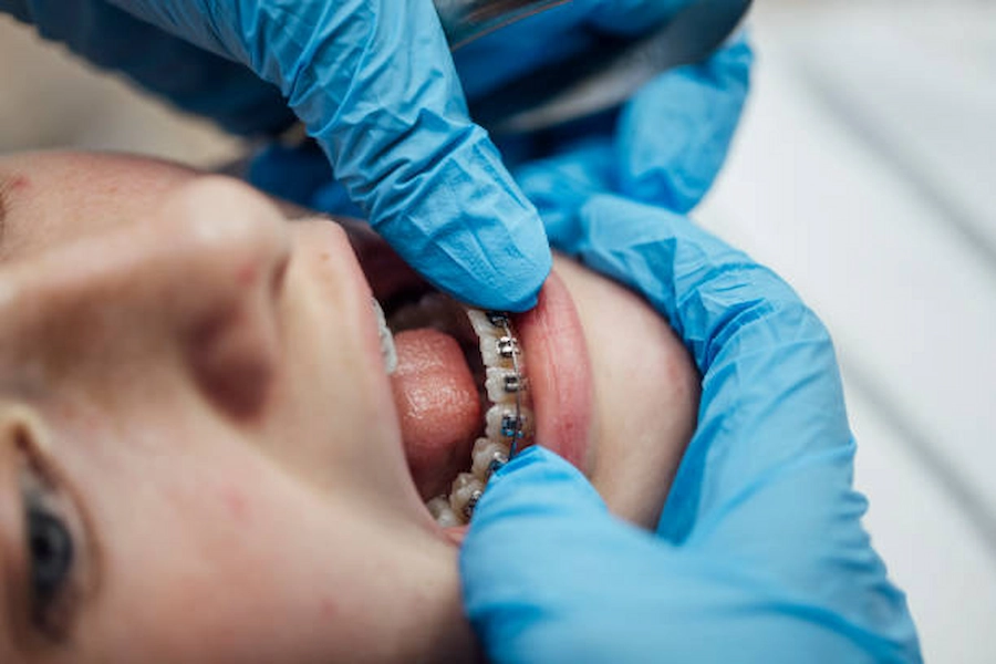 Expert care for your dental retainer needs.