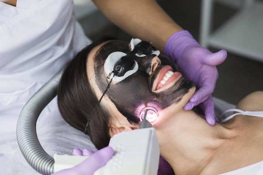 Carbon Laser Treatment session in Doha