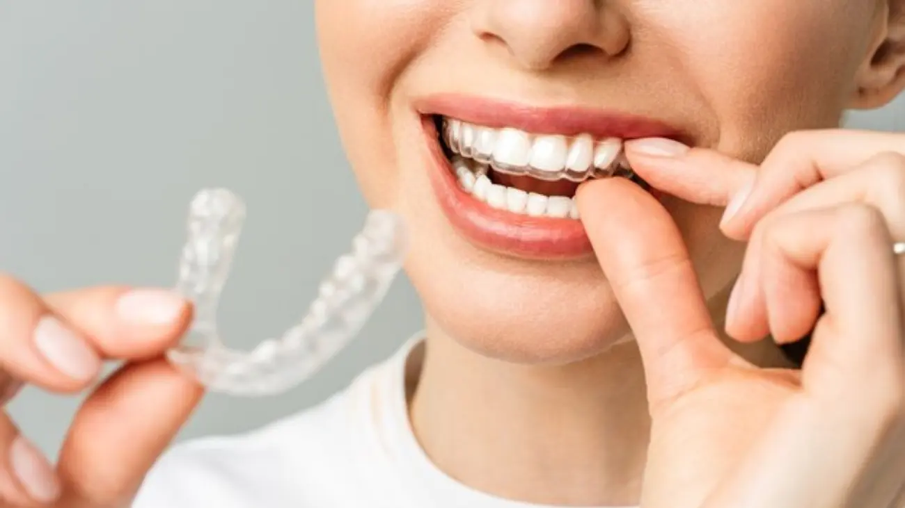 Invisible Aligners service at ATOS Medical Center