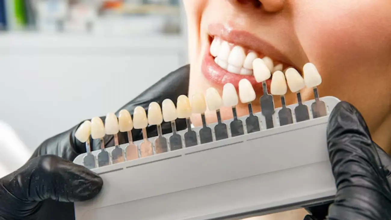 Crown bridge teeth service at ATOS Medical Center