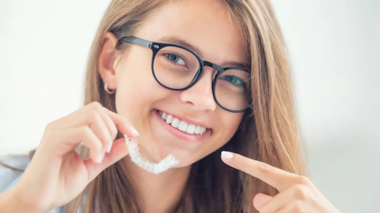 Smile aligners for achieving perfect teeth alignment