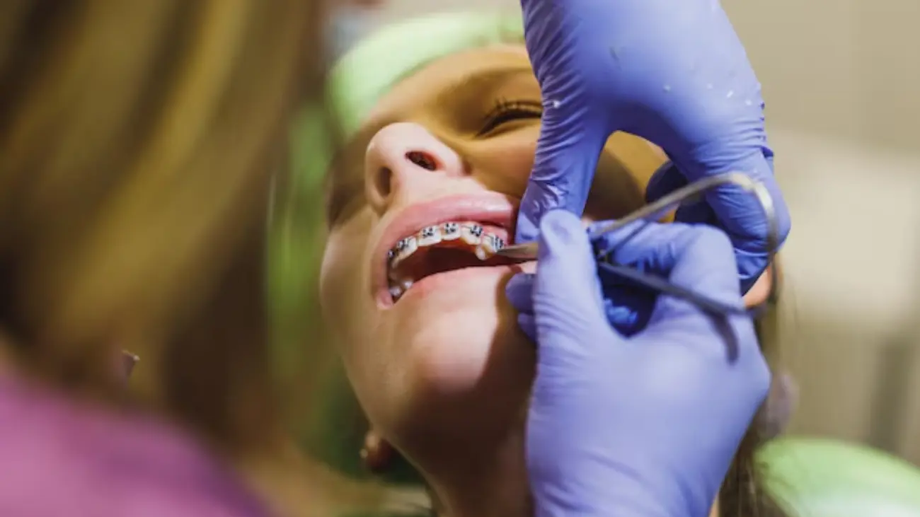 Jaw brace application for optimal jaw alignment.