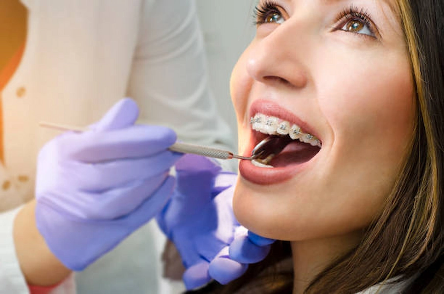 Retainers service for long-lasting smile maintenance.