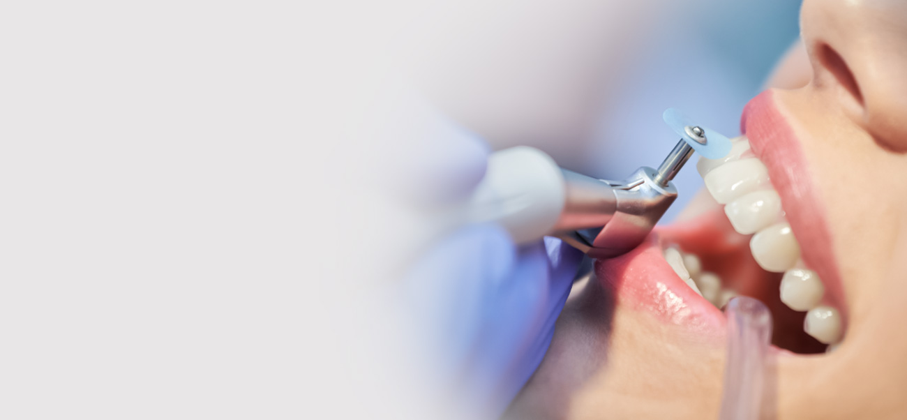 Dental polishing during an oral care appointment
