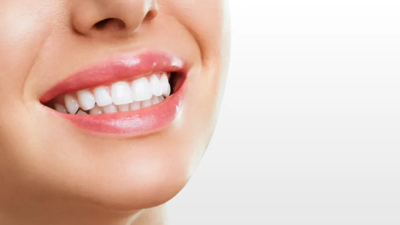 Professional gummy smile treatment for enhanced appearance