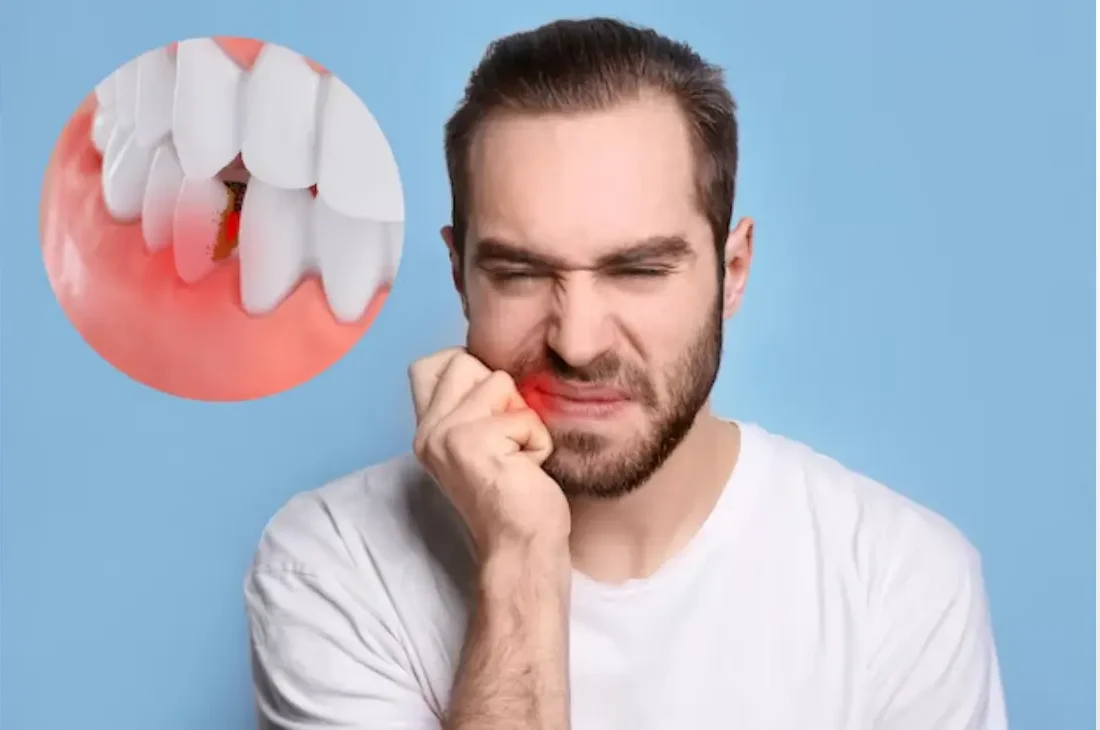 Sore gums from dentures relief services in Qatar