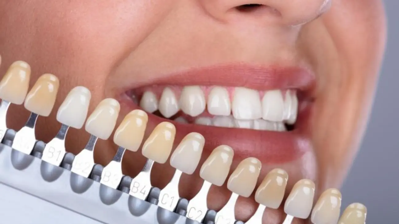Professional porcelain crown procedure at ATOS Medical Center.