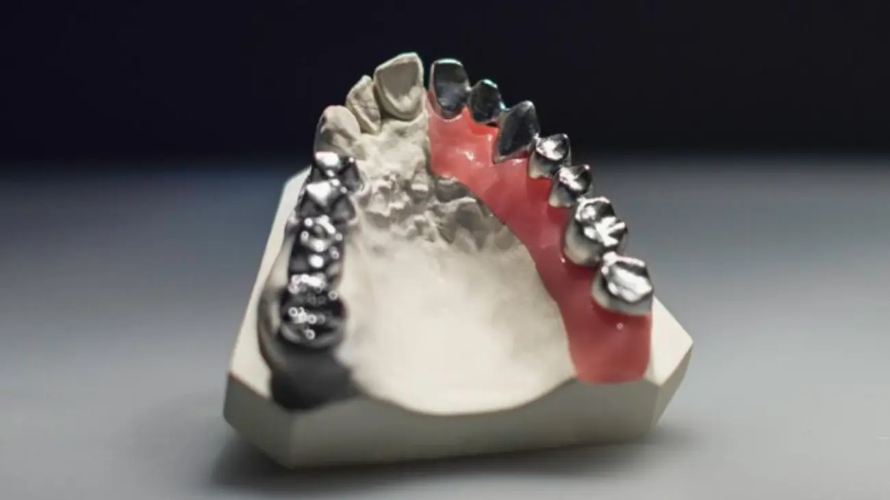 Dental professional consulting on titanium dentures.