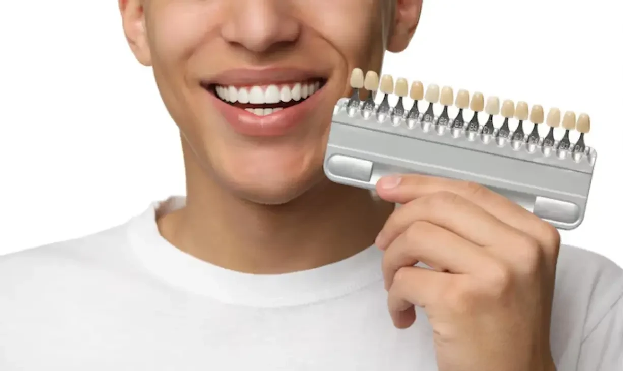 Coating on teeth to prevent cavities service image