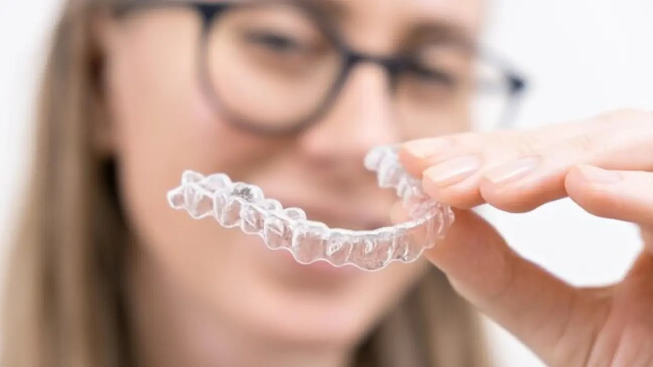 Visual representation of invisalign cost factors