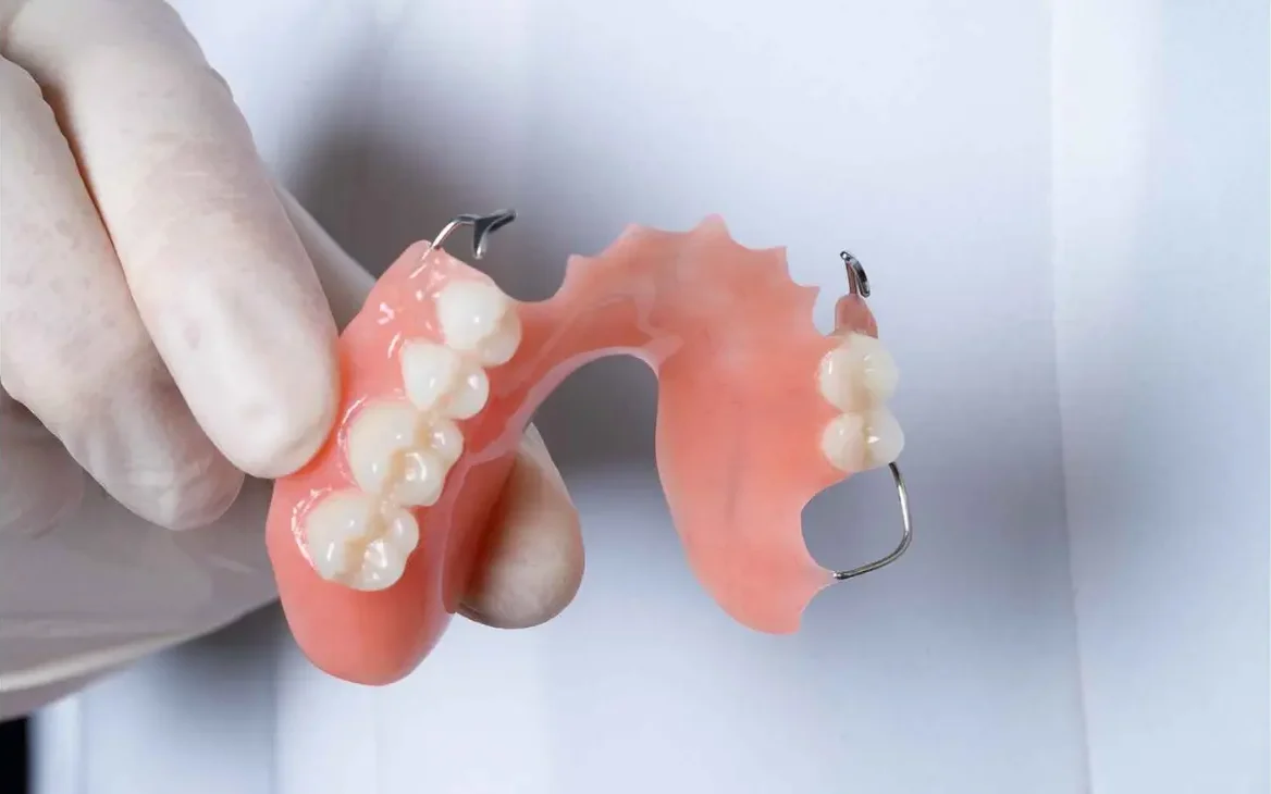Parts of removable partial denture service illustration