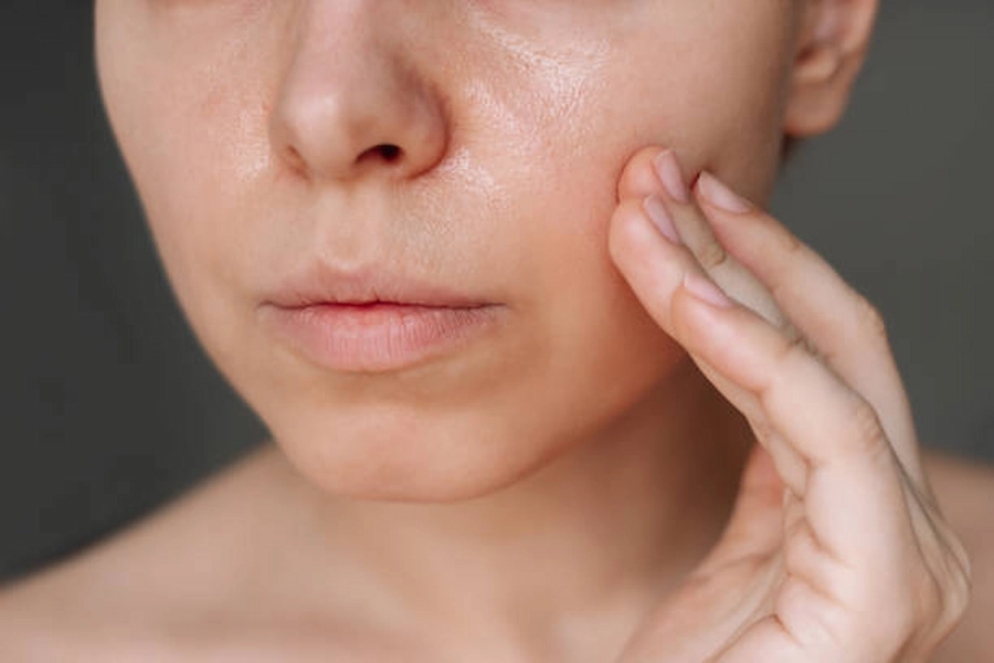 Oily Skin Care treatment at ATOS Medical Center