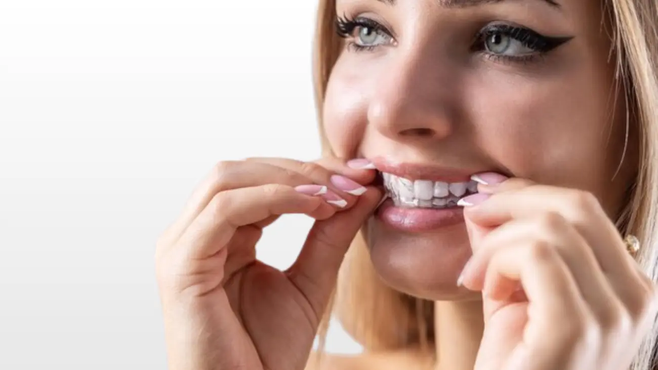 Clear aligners for discreet smile improvement.