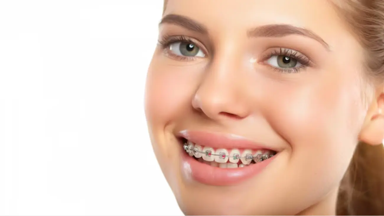 Braces adjustment every 3 weeks service image