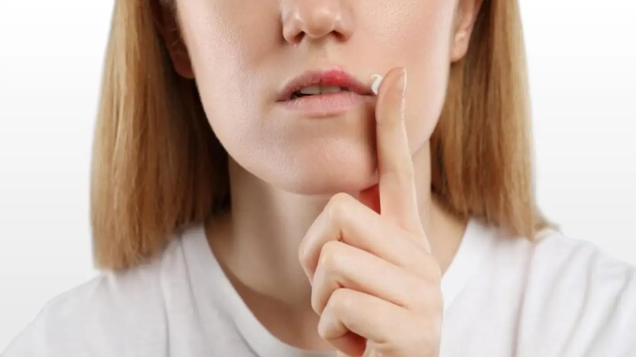 Comprehensive canker sore relief solutions in Qatar