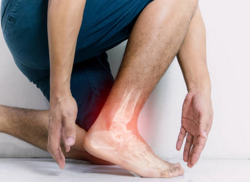 تمزق في أربطة القدم: العلاج والشفاء الفعال