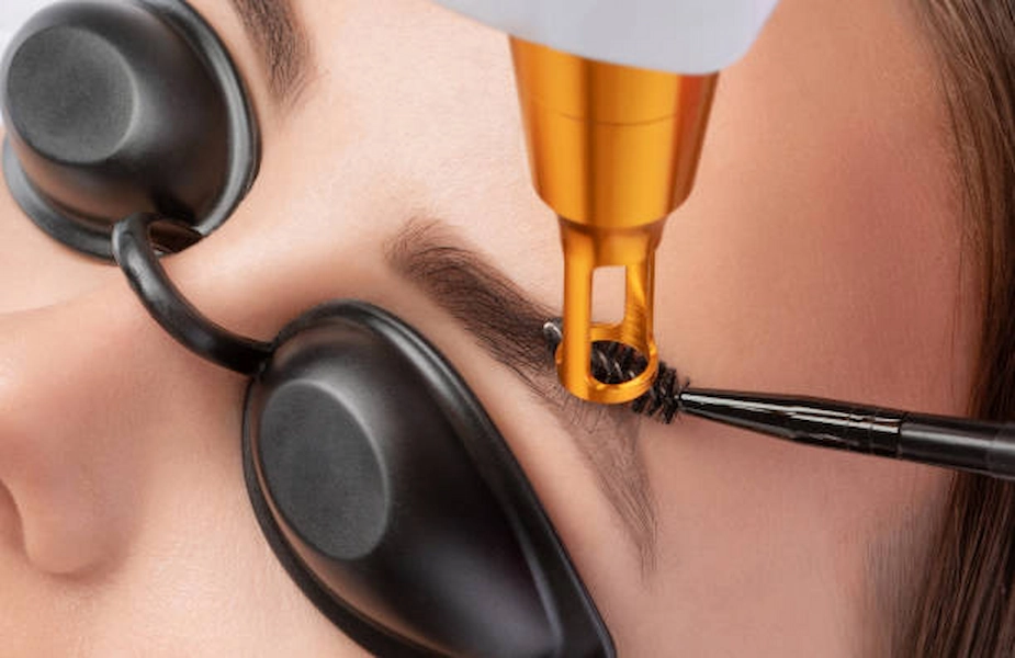 Results of Tattoo Removal for Face and Neck