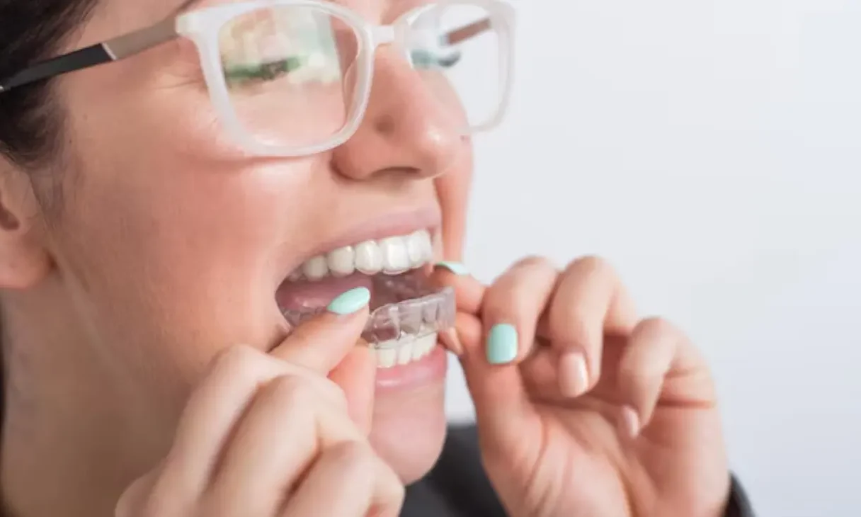 Braces without brackets service at ATOS Medical Center