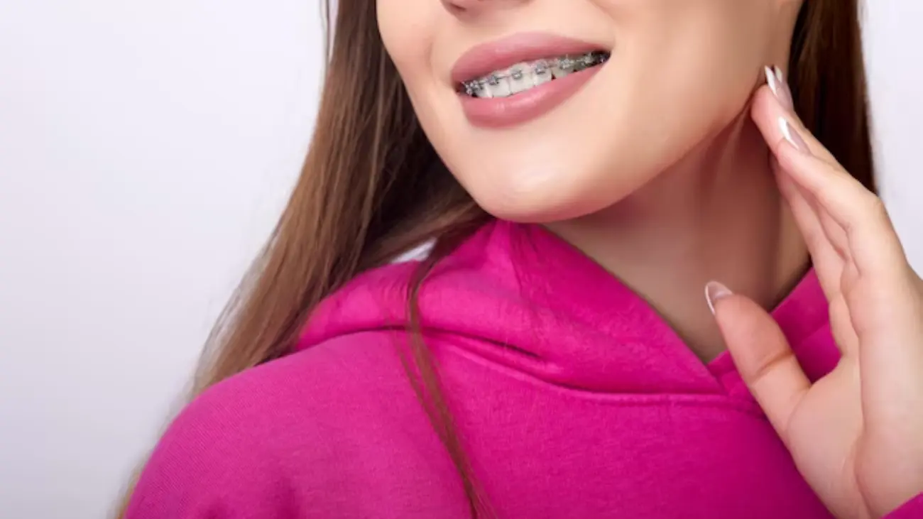 Transforming smiles with adult braces solutions.
