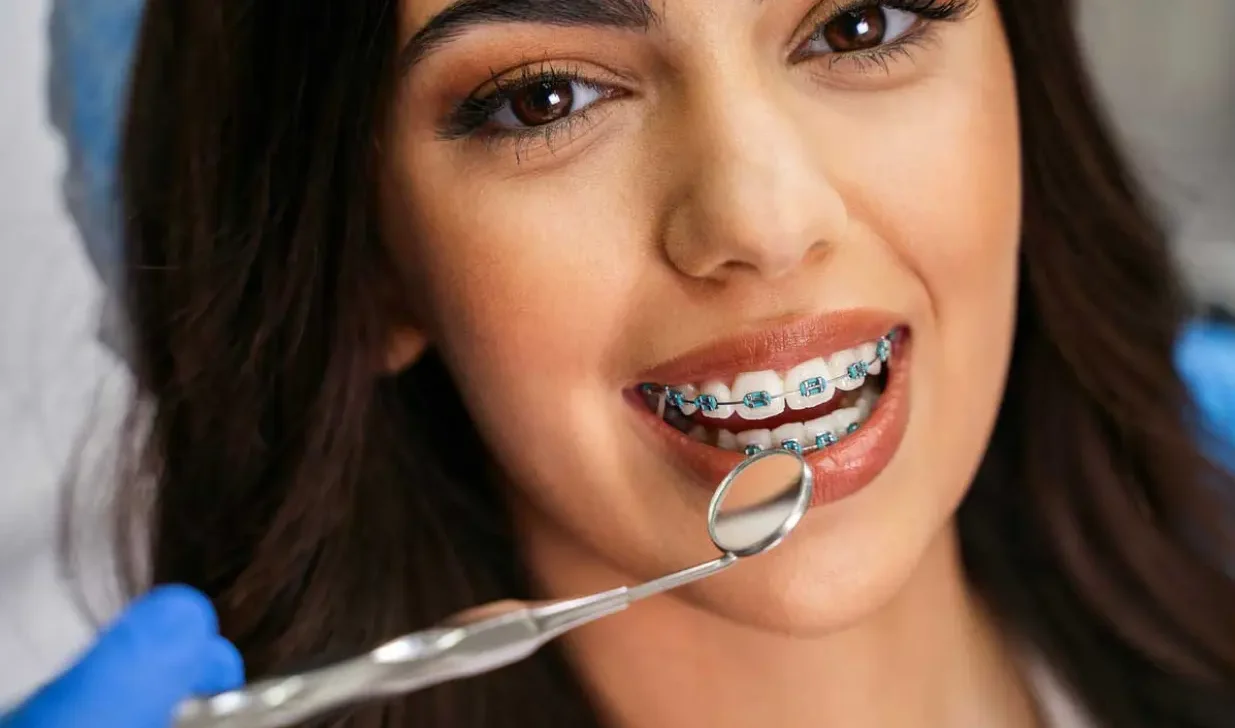 Braces service for straight and healthy teeth